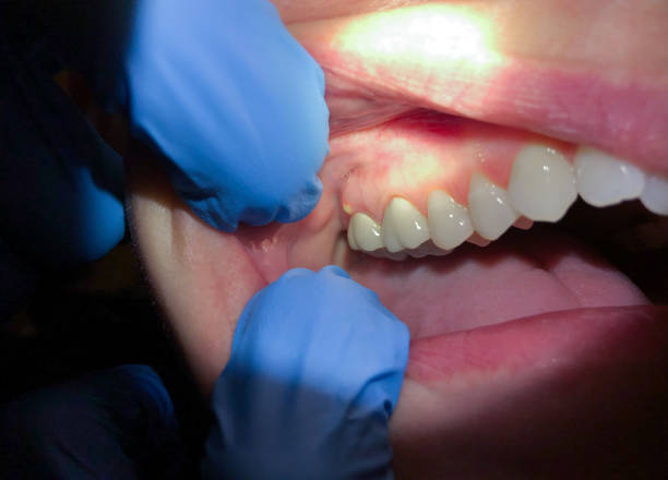 Best Urgent Dental Care for Toothache in Mpo, CA