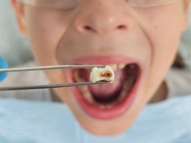Best Emergency Dental Services for Seniors in Mpo, CA